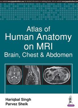 Atlas of Human Anatomy on MRI