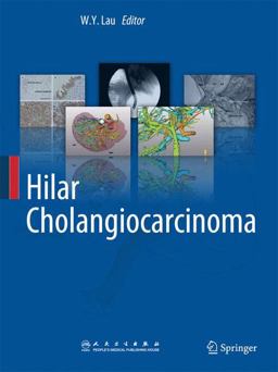 Hilar Cholangiocarcinoma  9789400764729 Front Cover
