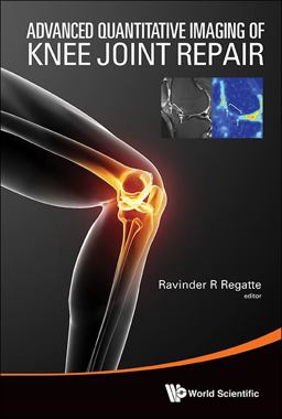 Advanced Quantitative Imaging of Knee Joint Repair  9789814579322 Front Cover
