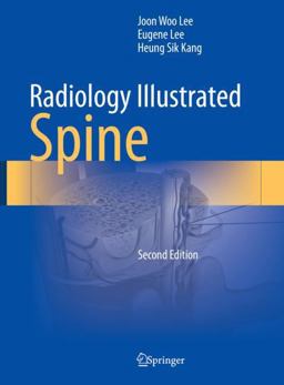Radiology Illustrated: Spine 2nd 9789819966110 Front Cover